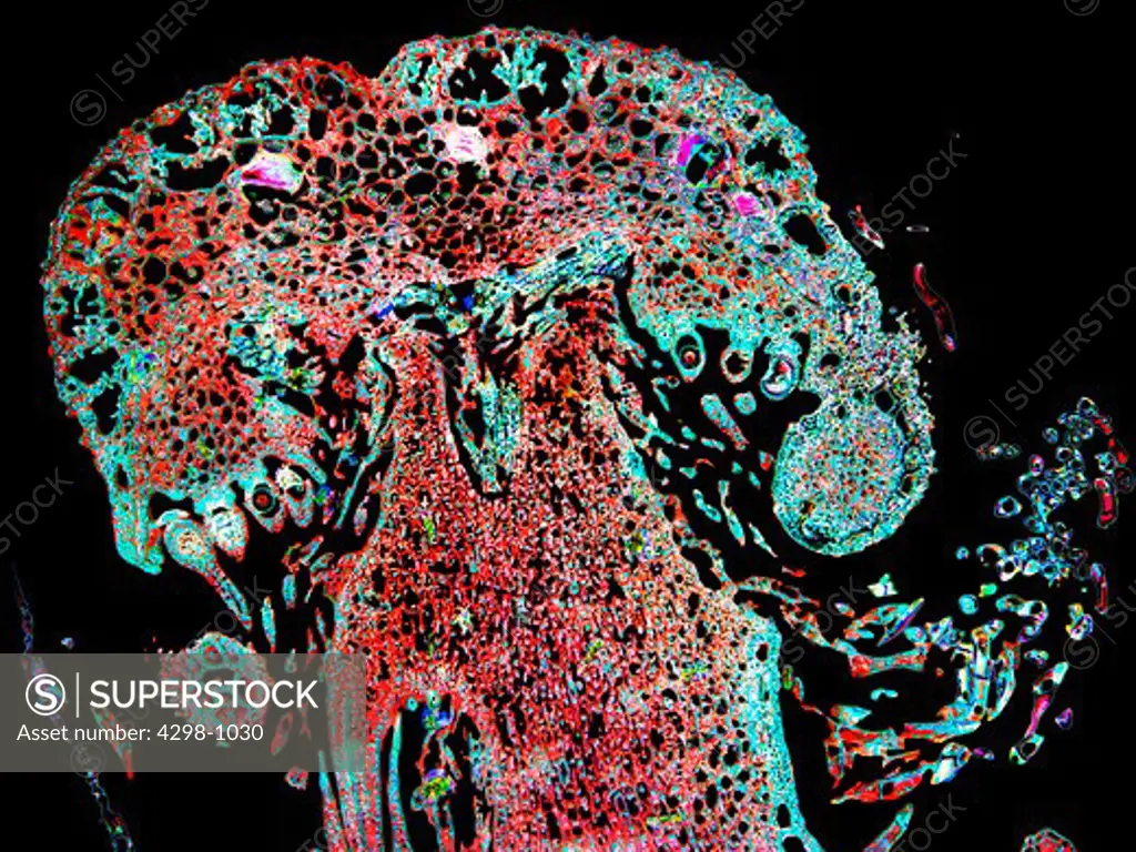Marchantia liverwort archegonium, magnification 40x, image enhanced