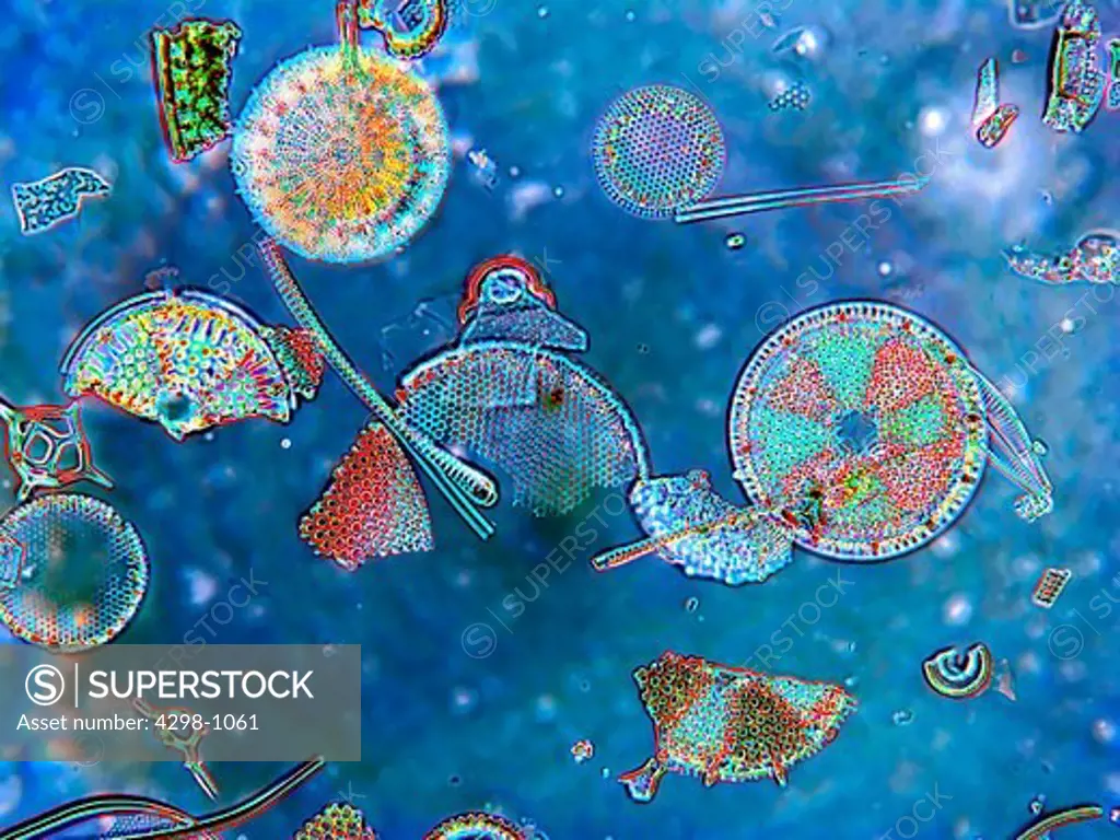 A variety of diatoms are displayed--from diatomaceous earth.  Magnification 400x.