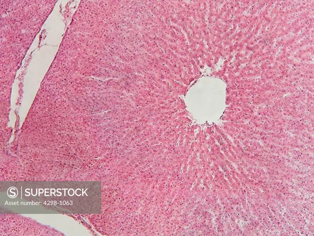 Dog liver tissue showing venules, central vein, and other hepatic structures.  Magnification 100X