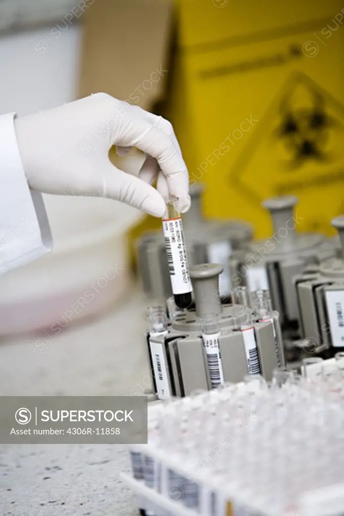 Hand holding a laboratory test.