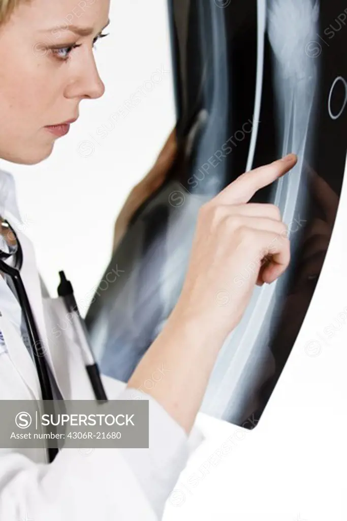 A female doctor holding an X-ray plate, Sweden.
