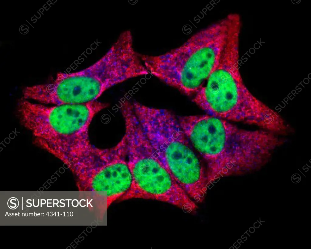 Immortal Cells:  HeLa Cells, Microscopic View