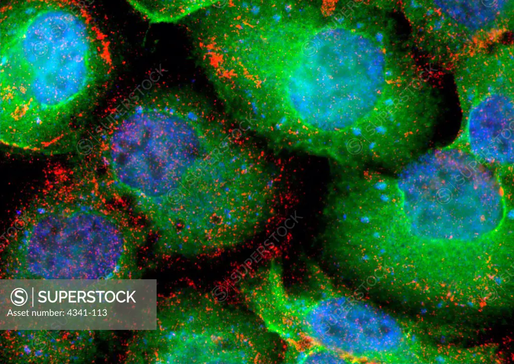 Supertough Cancer Cells, Microscopic View