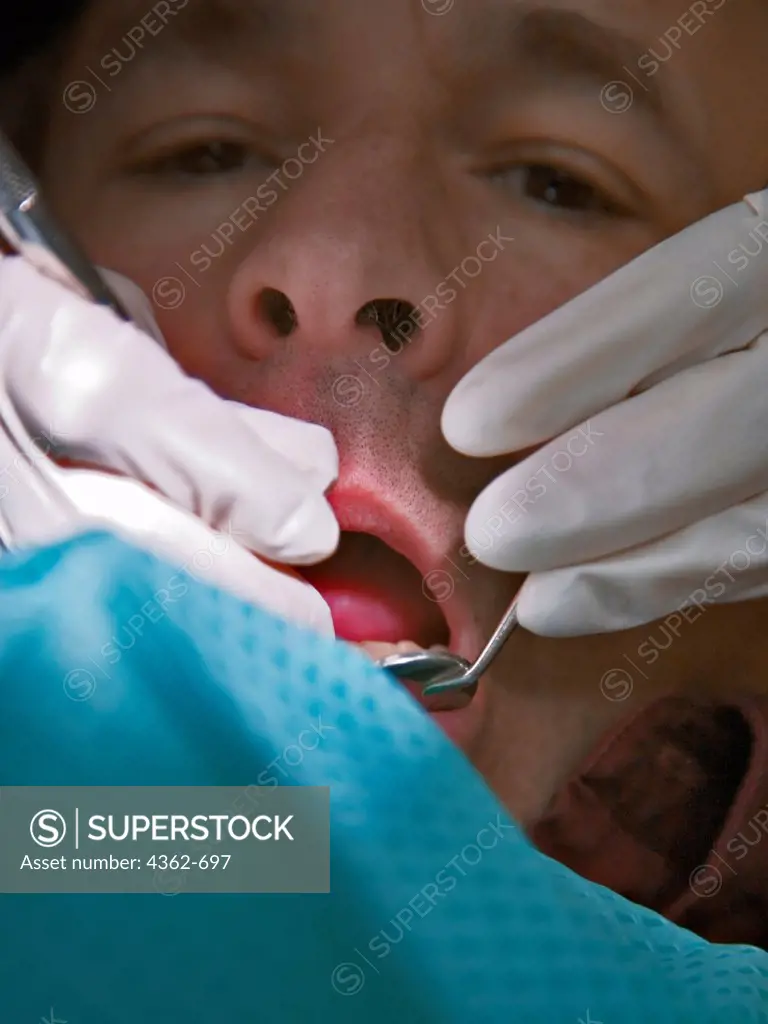 Man Having Teeth Cleaned