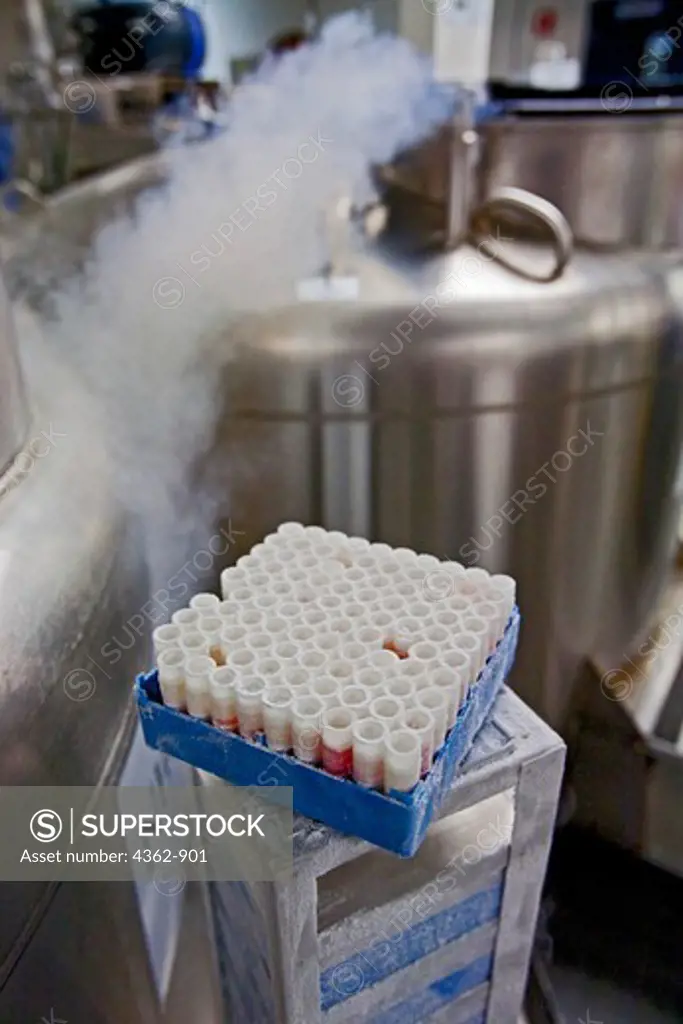 Tissue samples frozen in liquid nitrogen