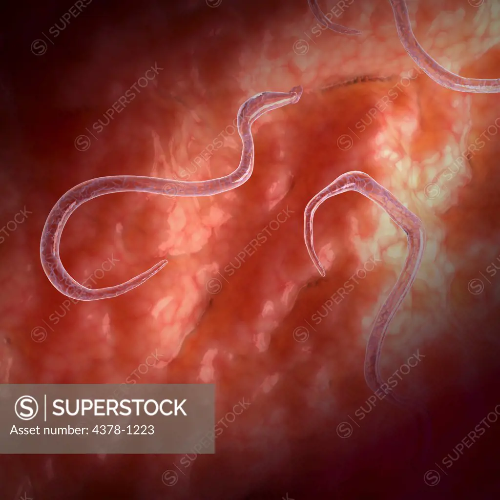 Hookworms, which are parasites that live in the small intestine.