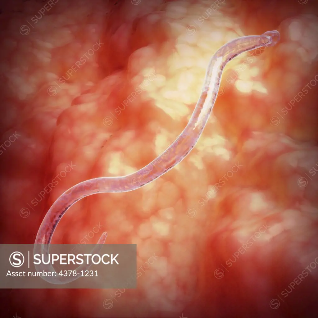 A hookworm, which is a parasite that lives in the small intestine.