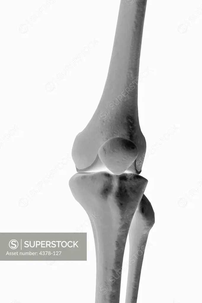 Stylized bones of the knee.