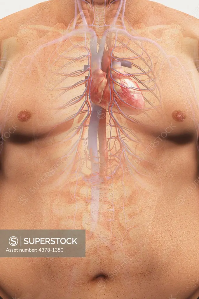 Image of the cardiovascular system layered over an overweight man's torso to show the relationship between obesity and heart disease.