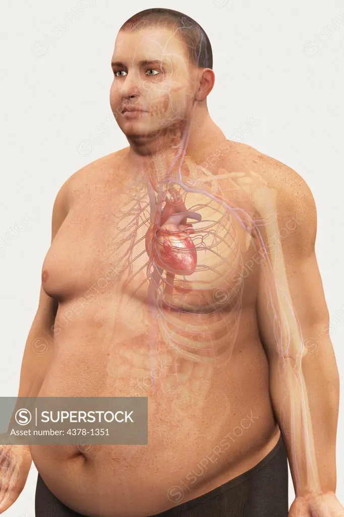 Image of the cardiovascular system layered over an overweight man's body to show the relationship between obesity and heart disease.