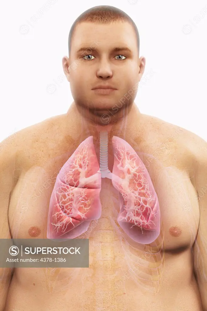 Human lungs layered over an overweight man's body to show the relationship between obesity and respiratory disorders.