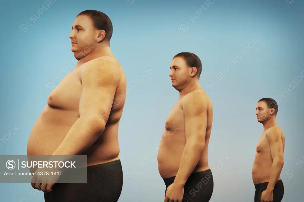 Comparison of the bodies of overweight and healthy men.