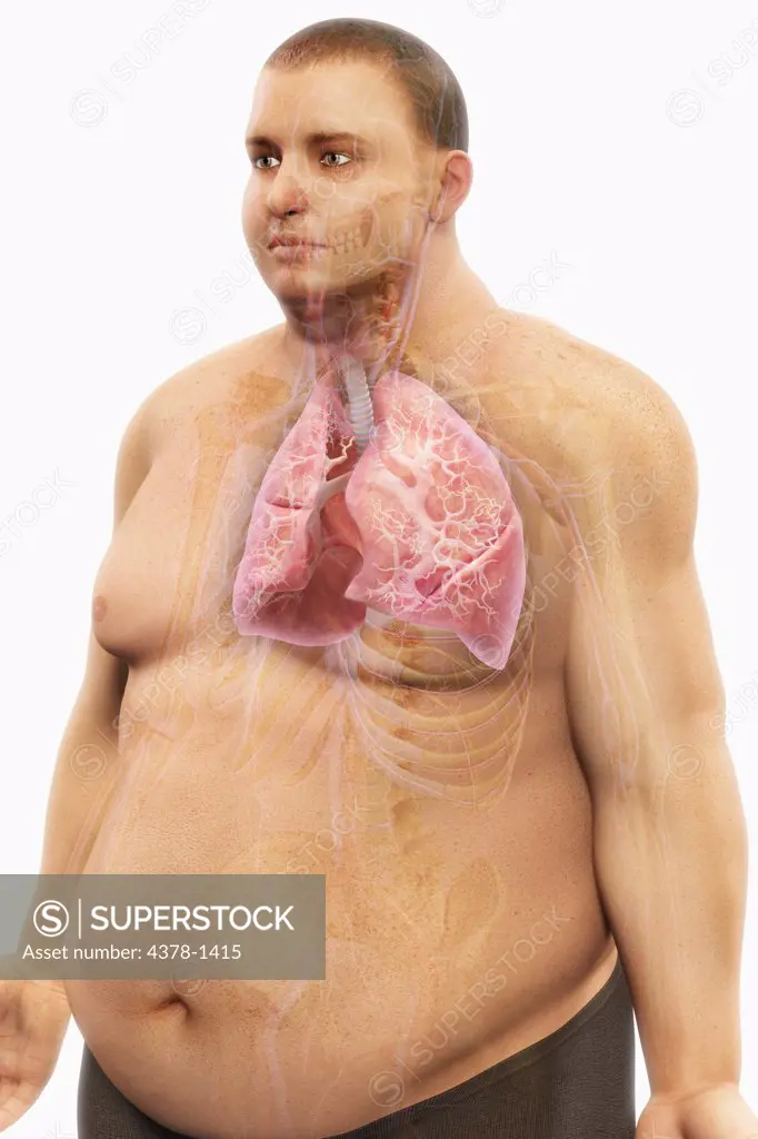 Human lungs layered over an overweight man's body to show the relationship between obesity and respiratory disorders.