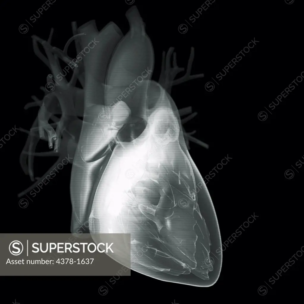 Diagram of a heart.