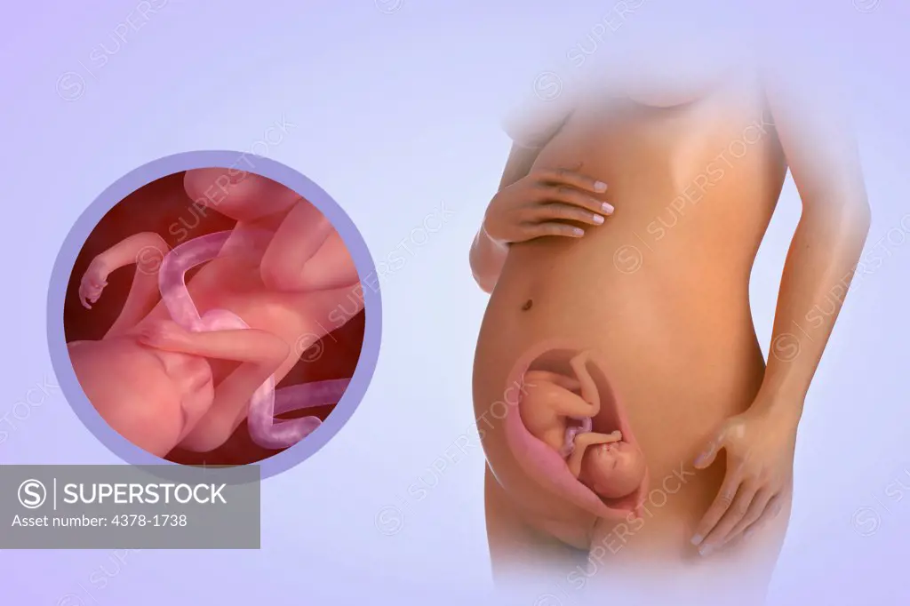 A human model showing pregnancy at week 24.