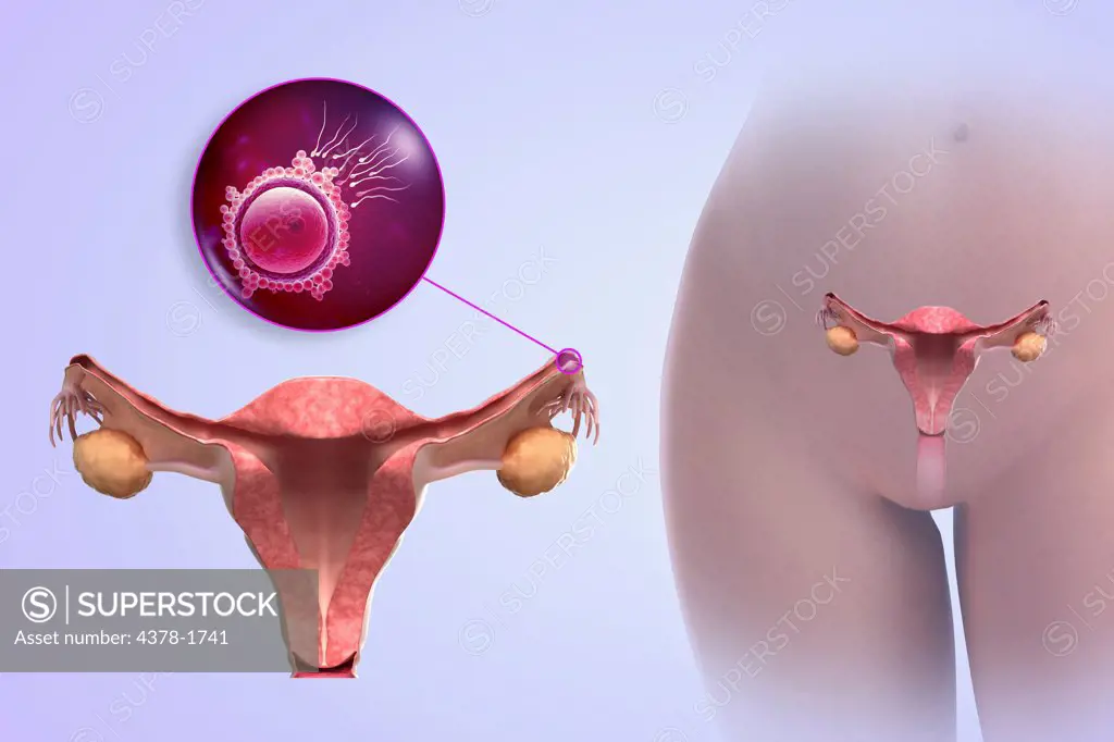 Sperm approaching and fertilizing an ovum within the fallopian tubes.