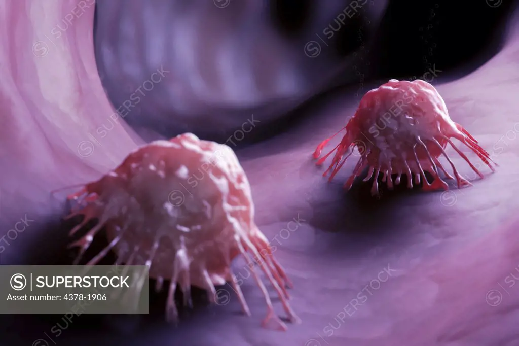 A group of cancer cells.