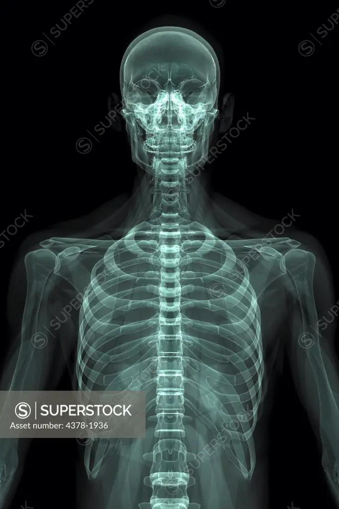 X-Ray image showing the rib cage.