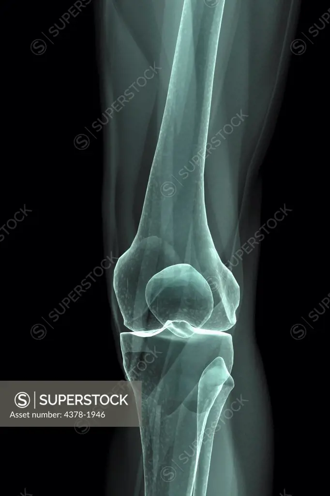 X-Ray image showing the knee joint.