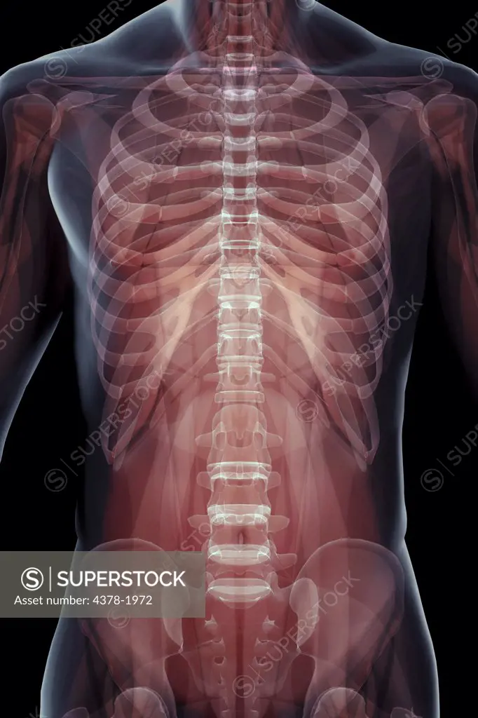 X-ray image showing the skeletal structure of the human thorax, rib cage and pelvis.
