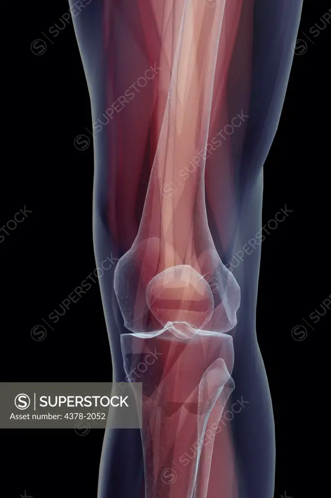 X-ray image showing the bones that make up the human knee; femur, tibia and patella.