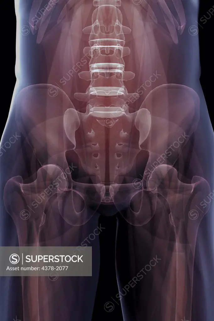 X-ray showing the skeletal structure of the human pelvis.