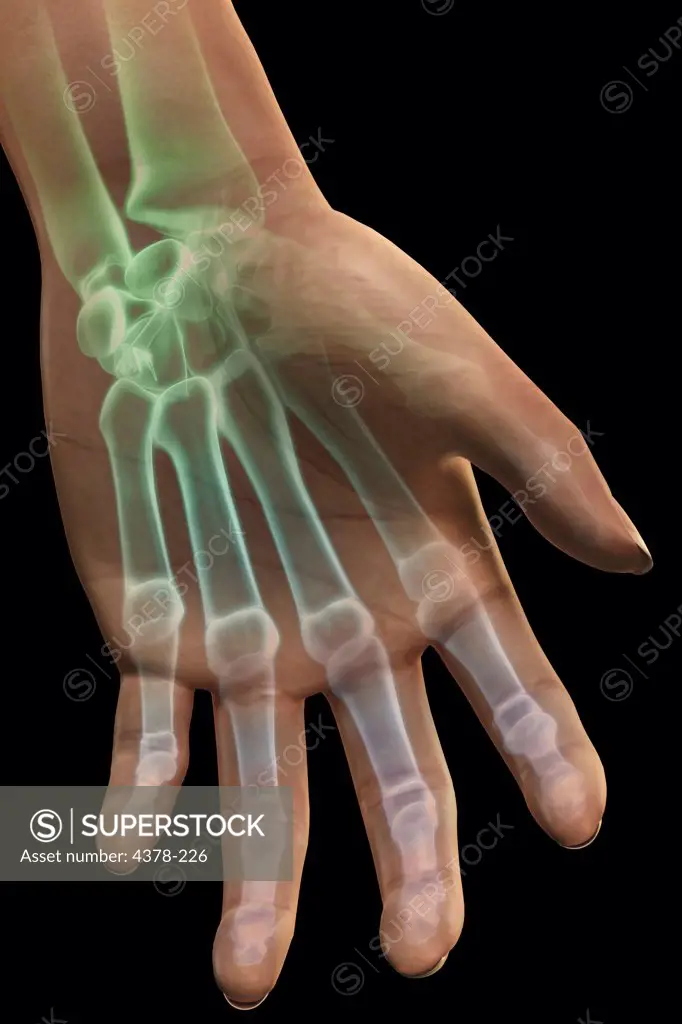Stylized bones of the left hand and wrist.