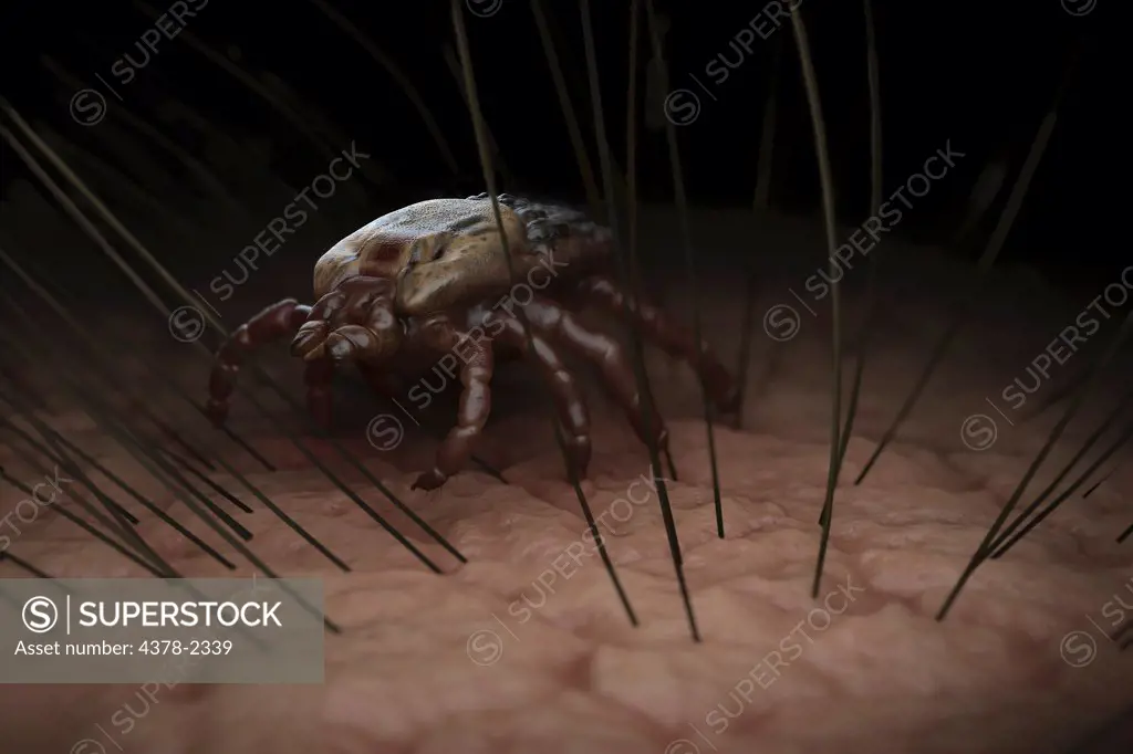 Tick (Ixodes) crawling along a surface growing hair follicles.