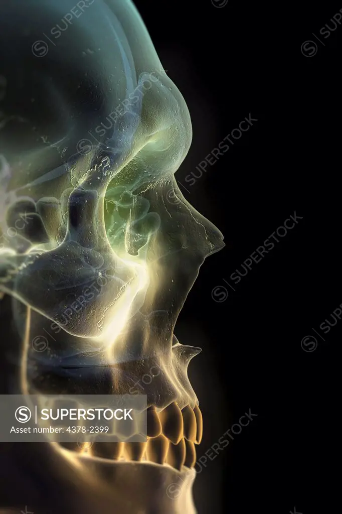 Anatomical model showing the human skull and paranasal sinuses.