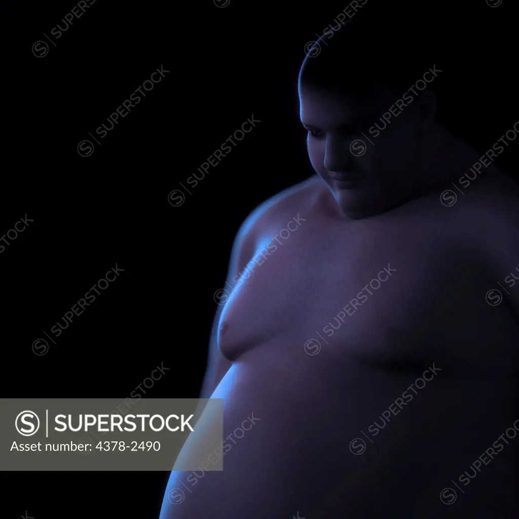 Anatomical model of a person with obesity.
