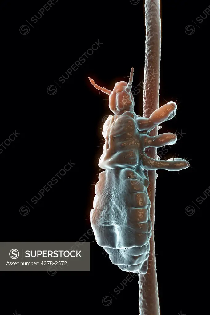 Parasitic head louse clinging to a hair follicle.
