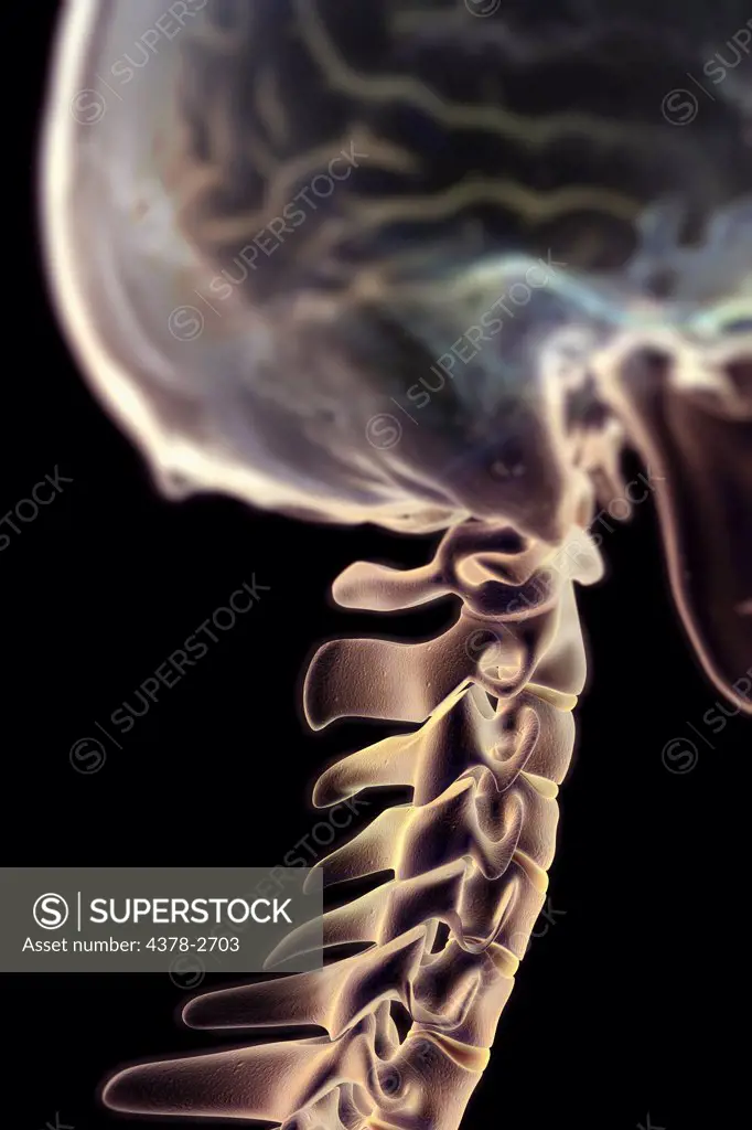 Side view of the cervical spine and skull. The brain is partially visible within the cranium.