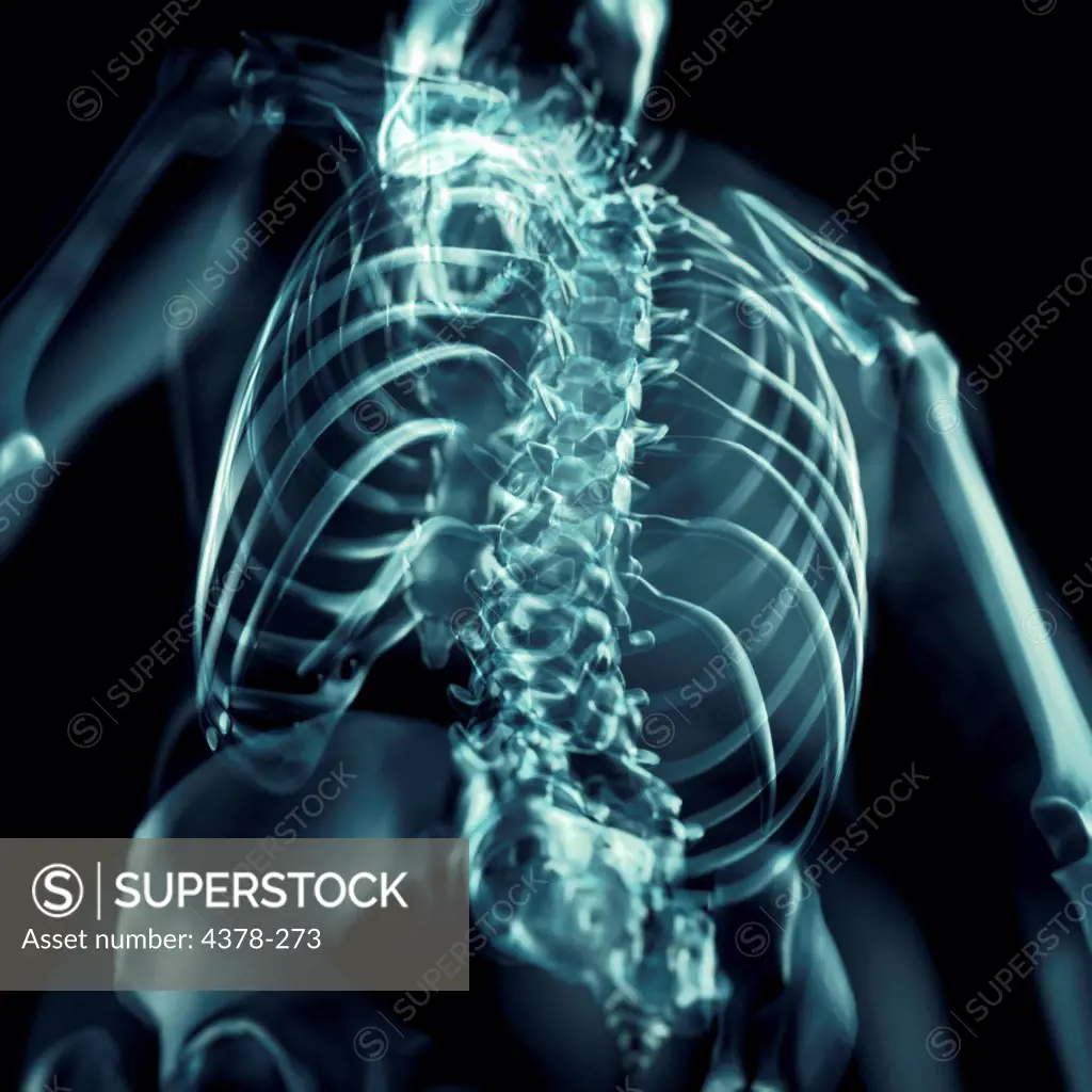 X-ray styled view from the rear of the bones of the spine and upper body.