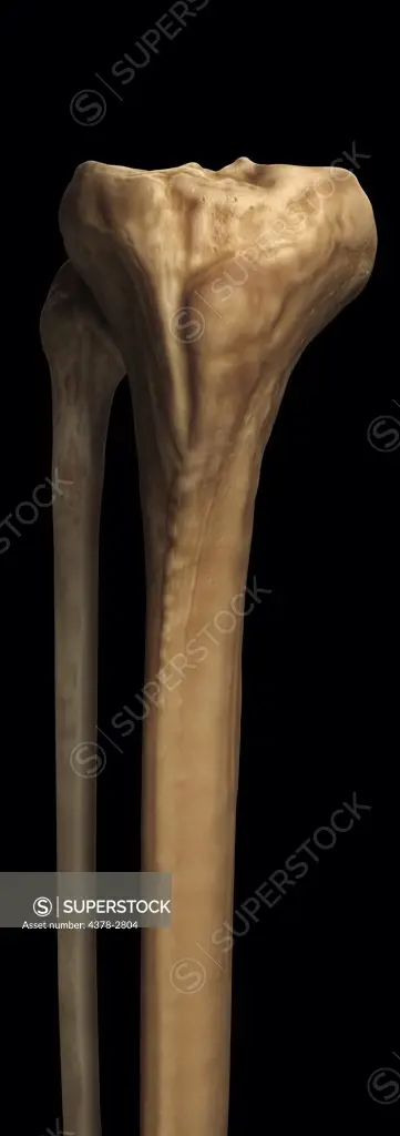 Model of the tibia and fibula bones that form part of the human leg.