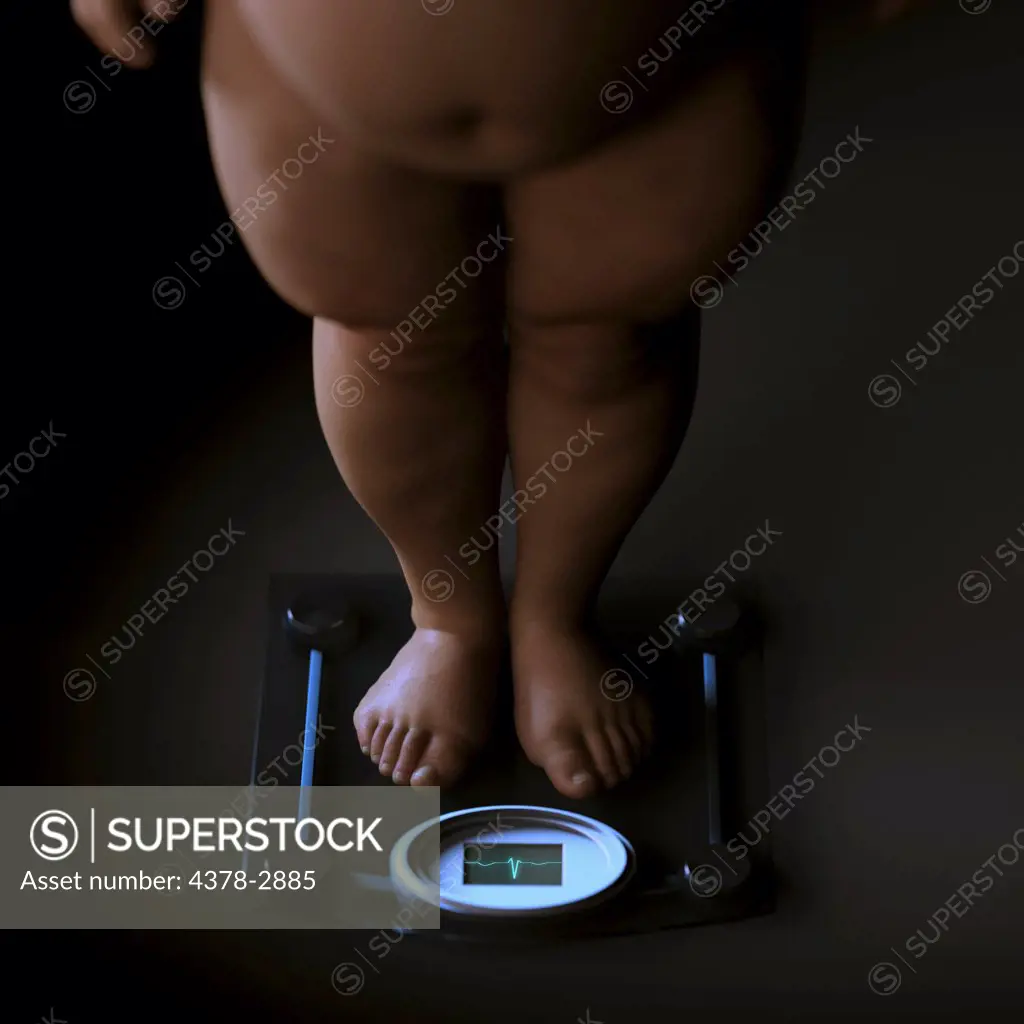 Anatomical model of an obese person standing on scales.