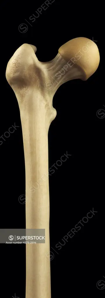 Model showing the upper part of the femur bone.
