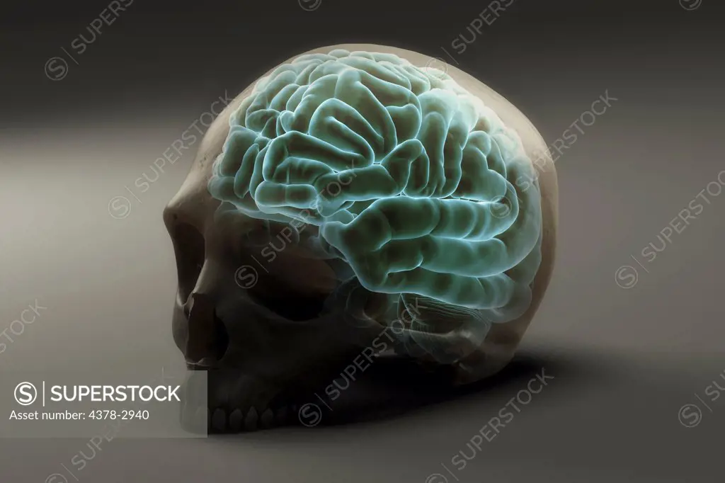 Brain situated within a human skull.