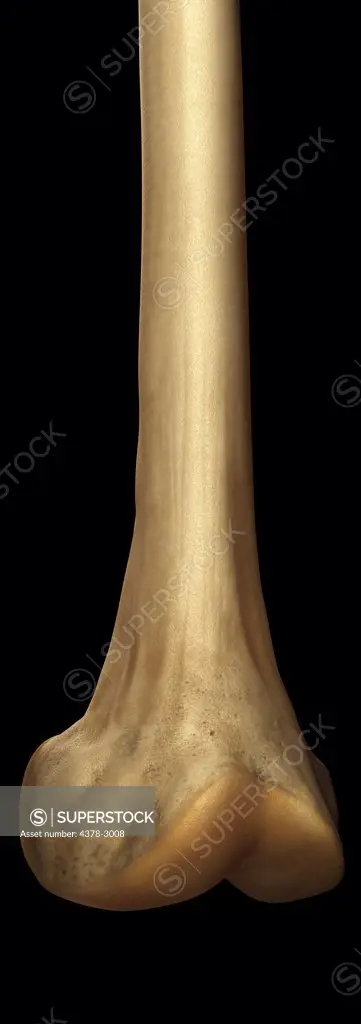 Model showing the lower part of the femur bone.