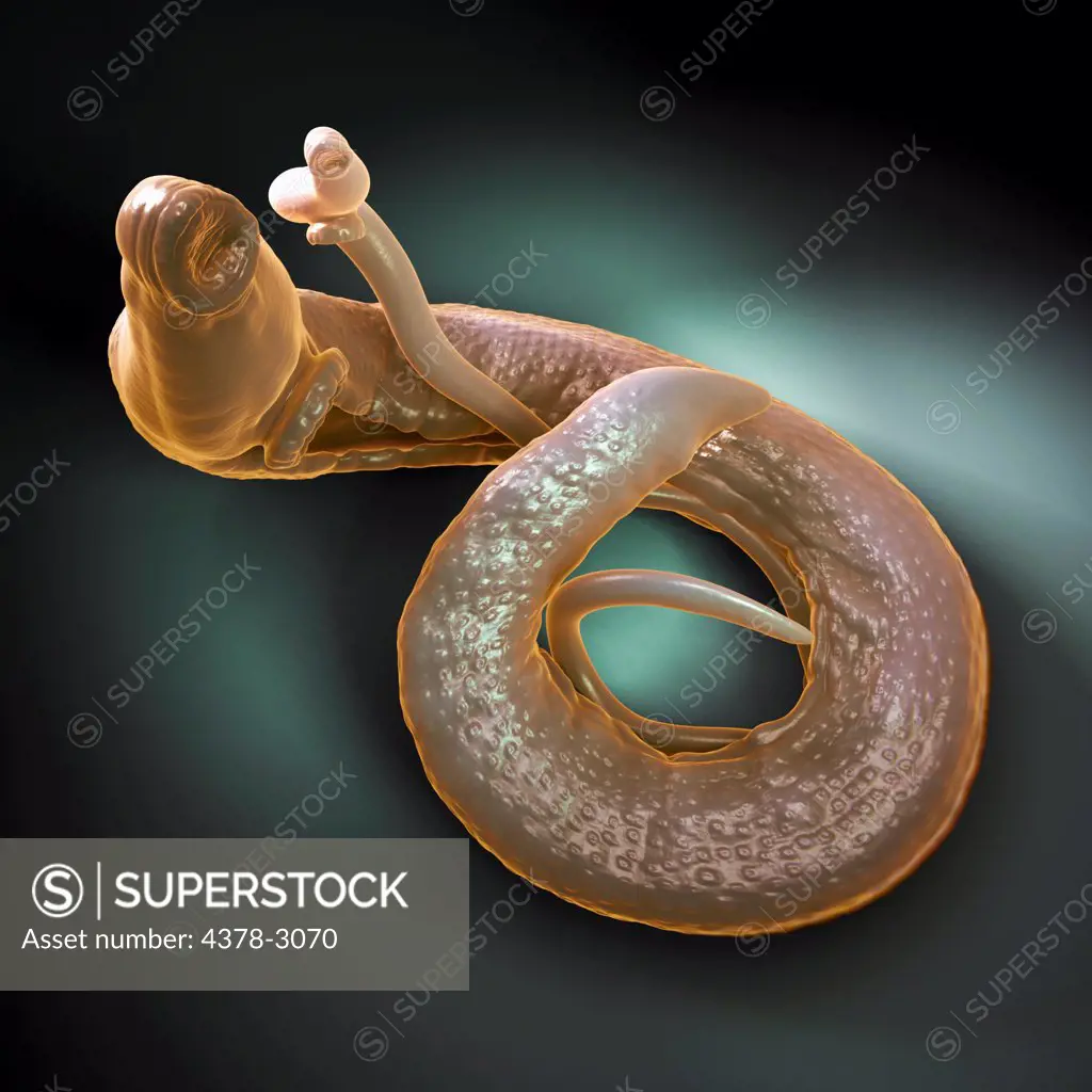 Schistosomiasis also known as snail fever is a parasitic disease caused by the parasitic worm of the genus Schistosoma. An adult male and female are seen here.