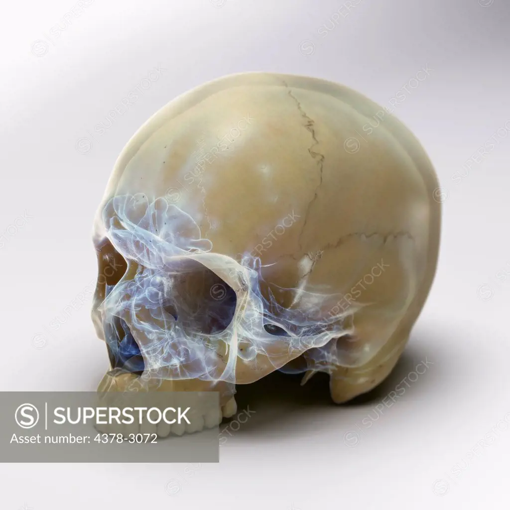 A human skull without the lower jaw on a white surface. The inner structures of the skull are visible with an X-ray appearance.