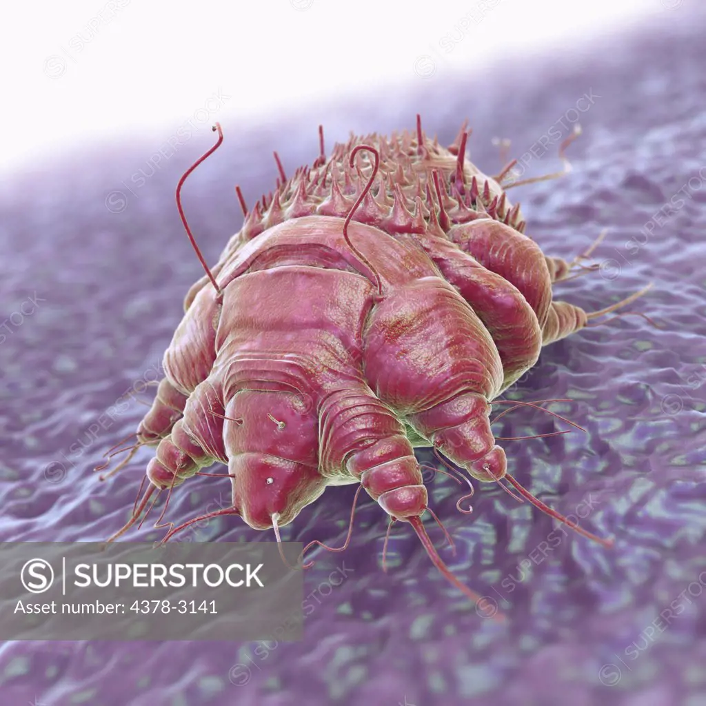 A single Sarcoptes scabiei mite which is the cause of the contagious skin infection Scabies. The mite burrows under the host's skin, causing intense allergic itching.