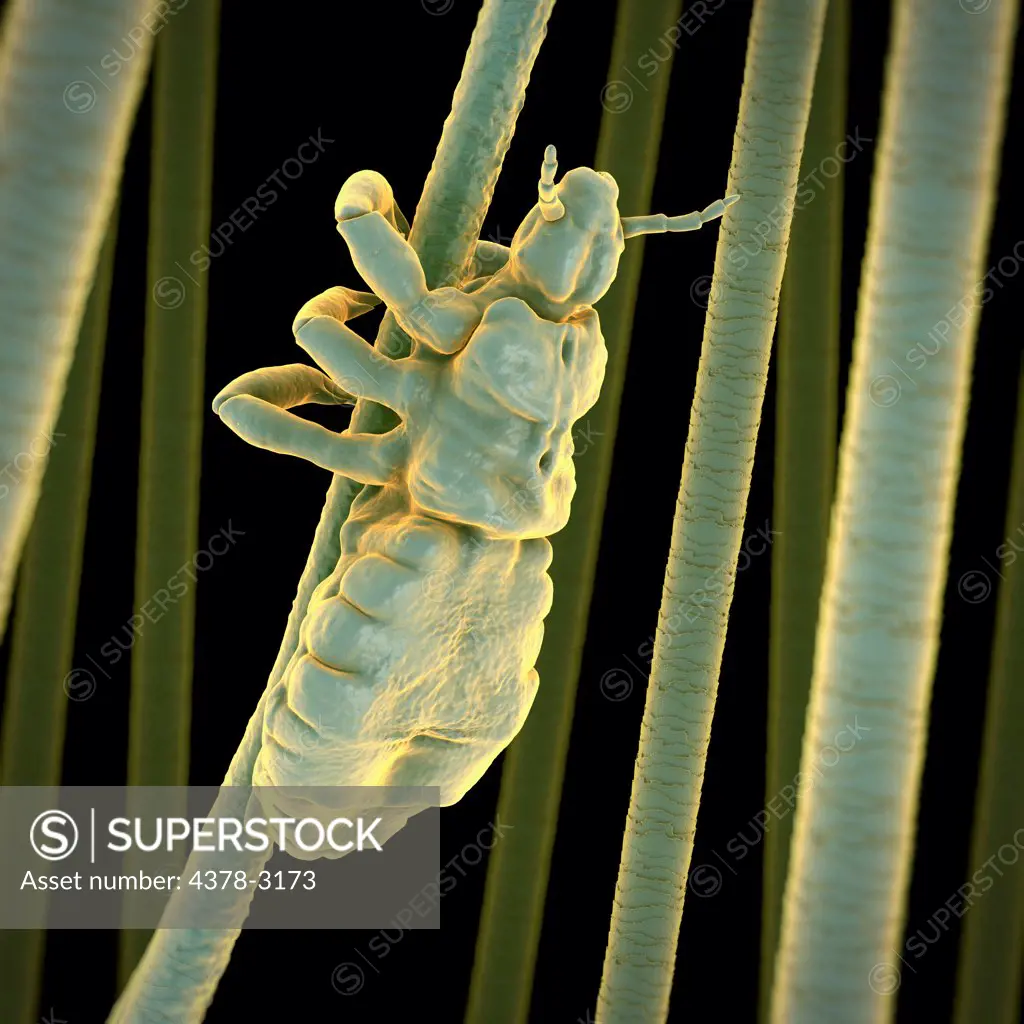 A single head louse clinging to a strand of hair.
