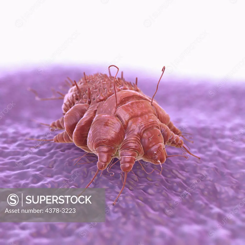 A single Sarcoptes scabiei mite which is the cause of the contagious skin infection Scabies. The mite burrows under the host's skin, causing intense allergic itching.