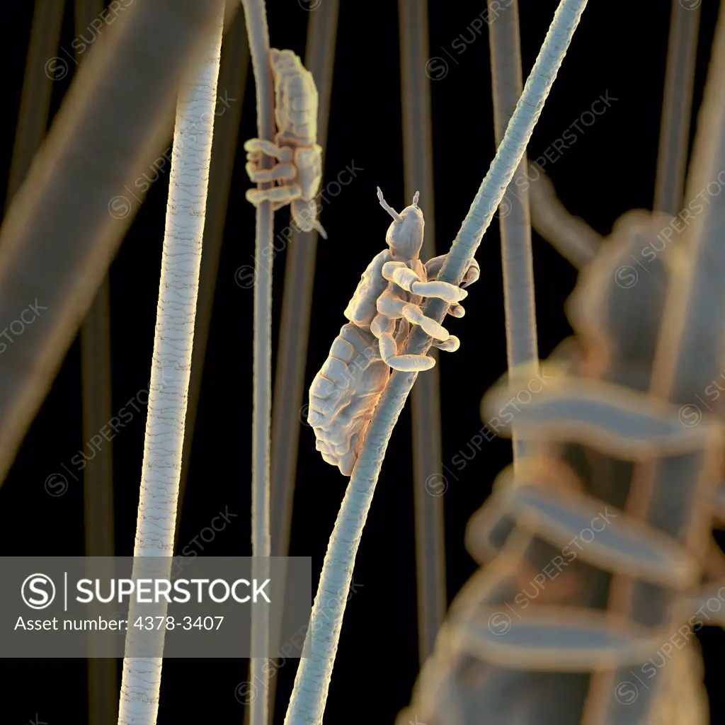 Multiple head lice cling to a hair strands.