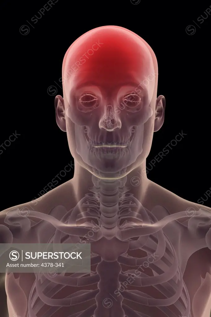 Front view of the bones of the head and neck within the skin (male). The head area is red to represent pain or a headache.