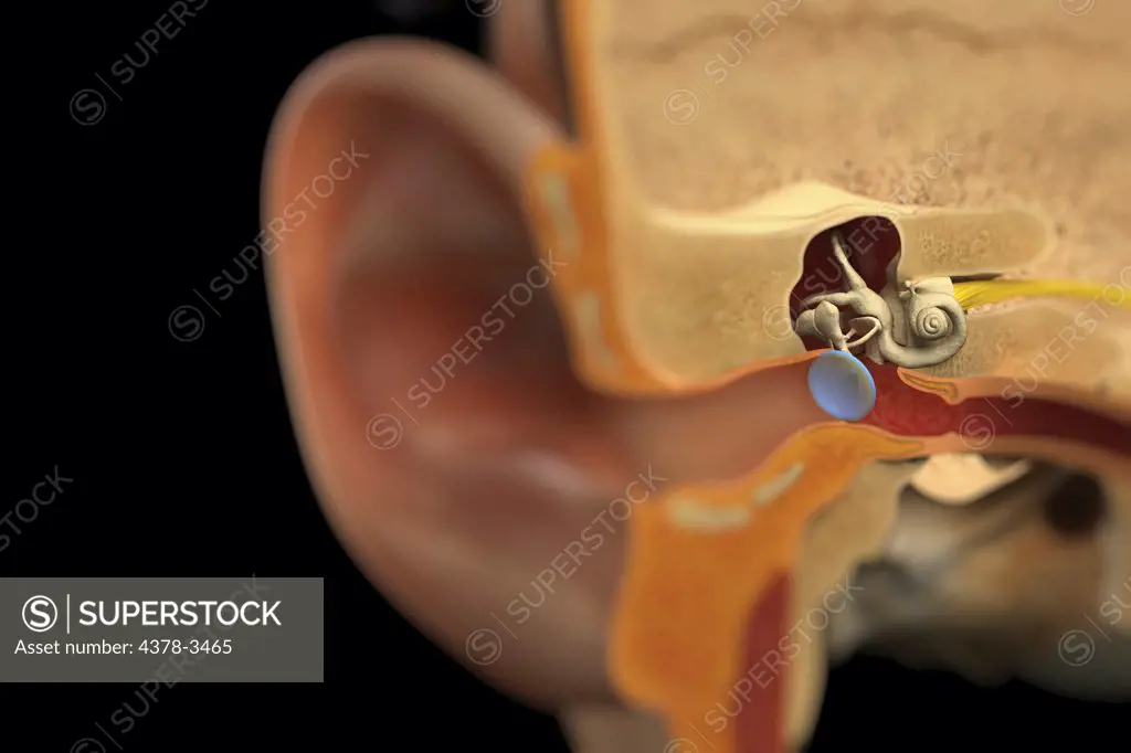 A sectional view of the human head revealing the anatomy of the ear canal and inner ear anatomy.