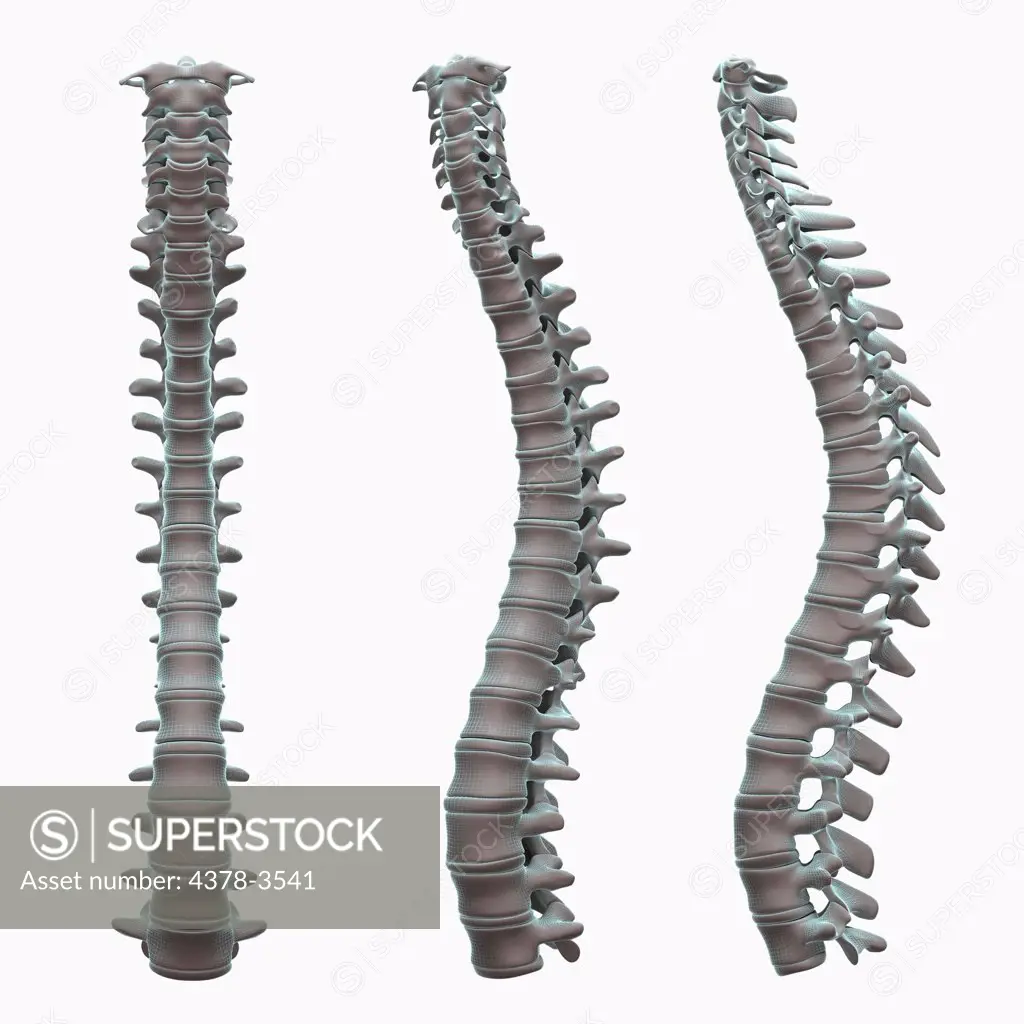 The spine viewed from three perspectives against a white background. The spinal vertebra have a wireframe appearance.