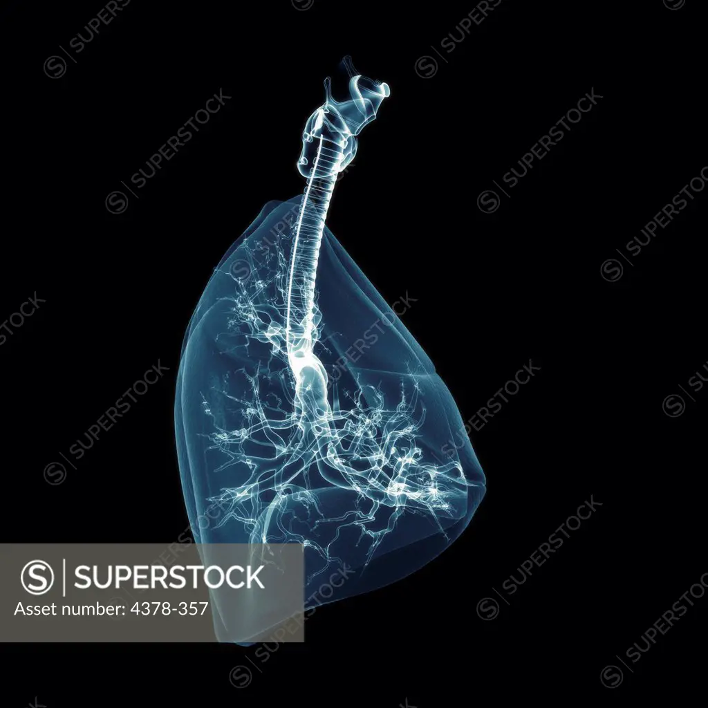 Stylized side view of the respiratory system in isolation. The lungs are transparent allowing the bronchioles to be seen.