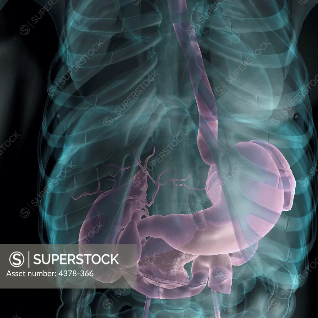 X-ray styled view of the abdomen. The stomach, gallbladder are highligted.