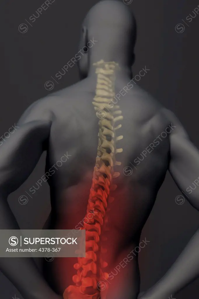 Rear view of a male figure with back pain. The spine is visible and is red to represent pain or injury.